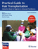 Practical Guide to Hair Transplantation: Interactive Study for Beginner to Advanced Practitioners