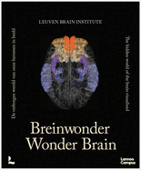 Wonder Brain