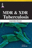 Mdr & Xdr Tuberculosis