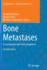 Bone Metastases