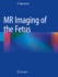 Mr Imaging of the Fetus