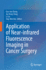 Application of Near-Infrared Fluorescence Imaging in Cancer Surgery