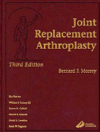 Joint Replacement Arthroplasty
