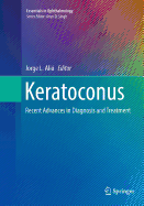 Keratoconus: Recent Advances in Diagnosis and Treatment