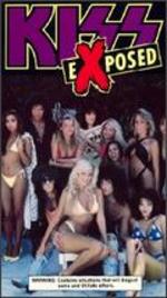 KISS: Exposed