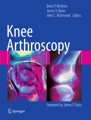 Knee Arthroscopy - McKeon, Brian (Editor), and Bono, James V. (Editor), and Richmond, John C. (Editor)