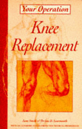 Knee Replacement