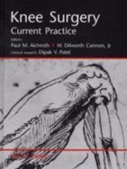Knee Surgery: Current Practice