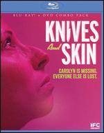 Knives and Skin