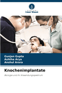 Knochenimplantate