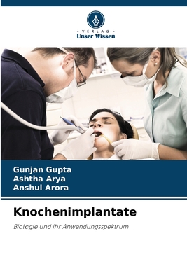 Knochenimplantate - Gupta, Gunjan, and Arya, Ashtha, and Arora, Anshul
