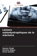 L?sions ost?odystrophiques de la m?choire