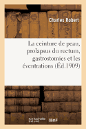 La Ceinture de Peau: Prolapsus Du Rectum, Application Dans Les Gastrostomies Et Les ?ventrations