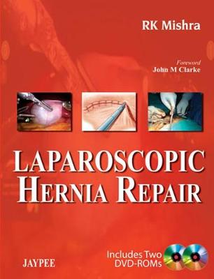 Laparoscopic Hernia Repair - Mishra, RK