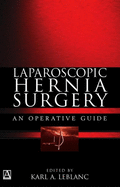 Laparoscopic Hernia Surgery: An Operative Guide