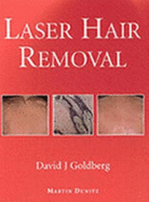 Laser Hair Removal