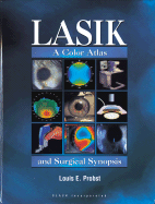 Lasik: A Color Atlas and Surgical Synopsis