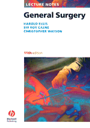 Lecture Notes: General Surgery