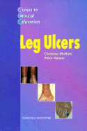 Leg Ulcers - Harper, Peter S, and Moffatt, Christine, CBE, Ma, PhD, RGN