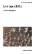 Lens Implantation: 30 Years of Progress
