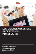 Les D?faillances Des Facettes En Porcelaine