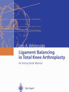 Ligament Balancing in Total Knee Arthroplasty: An Instructional Manual