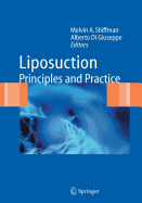 Liposuction: Principles and Practice