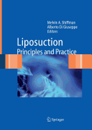 Liposuction: Principles and Practice