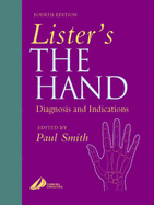 Lister's the Hand: Diagnosis and Indications