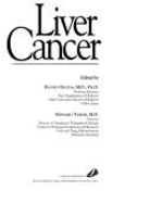 Liver Cancer