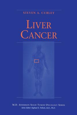 Liver Cancer - Curley, Steven A (Editor)