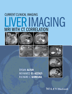 Liver Imaging: MRI with CT Correlation