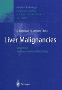 Liver Malignancies: Diagnostic and Interventional Radiology