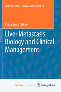 Liver Metastasis: Biology and Clinical Management