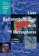 Liver Radioembolization with 90y Microspheres