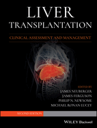 Liver Transplantation: Clinical Assessment and Management
