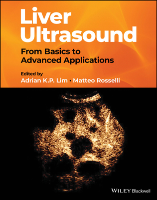 Liver Ultrasound: From Basics to Advanced Applications - Lim, Adrian K P (Editor), and Rosselli, Matteo (Editor)