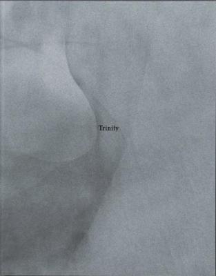 Living Trust - Ellison, Buck
