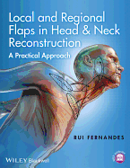 Local and Regional Flaps in Head and Neck Reconstruction: A Practical Approach