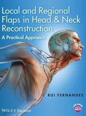 Local and Regional Flaps in Head and Neck Reconstruction: A Practical Approach - Fernandes, Rui, DMD, MD