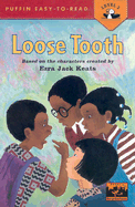 Loose Tooth
