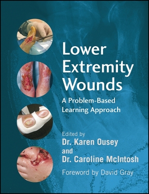 Lower Extremity Wounds: A Problem-Based Learning Approach - Ousey, Karen (Editor), and McIntosh, Caroline (Editor)