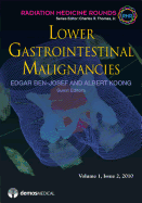Lower Gastrointestinal Malignancies