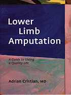 Lower Limb Amputation: A Guide to Living a Quality Life