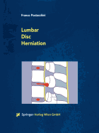Lumbar Disc Herniation