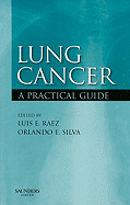 Lung Cancer: A Practical Guide