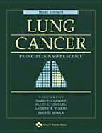 Lung Cancer: Principles and Practice
