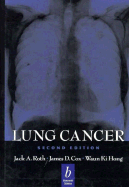 Lung Cancer