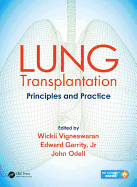 Lung Transplantation: Principles and Practice