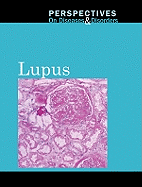 Lupus